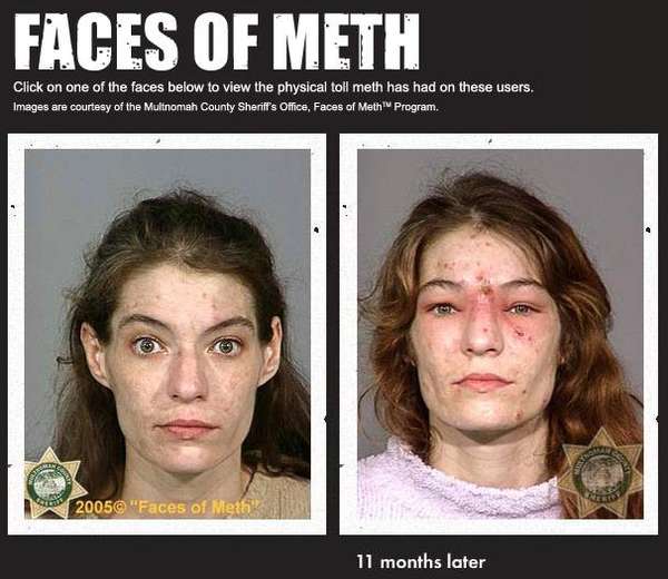 Drug Induced Makeovers: Celeb Zombies Made from Methamphetamines
