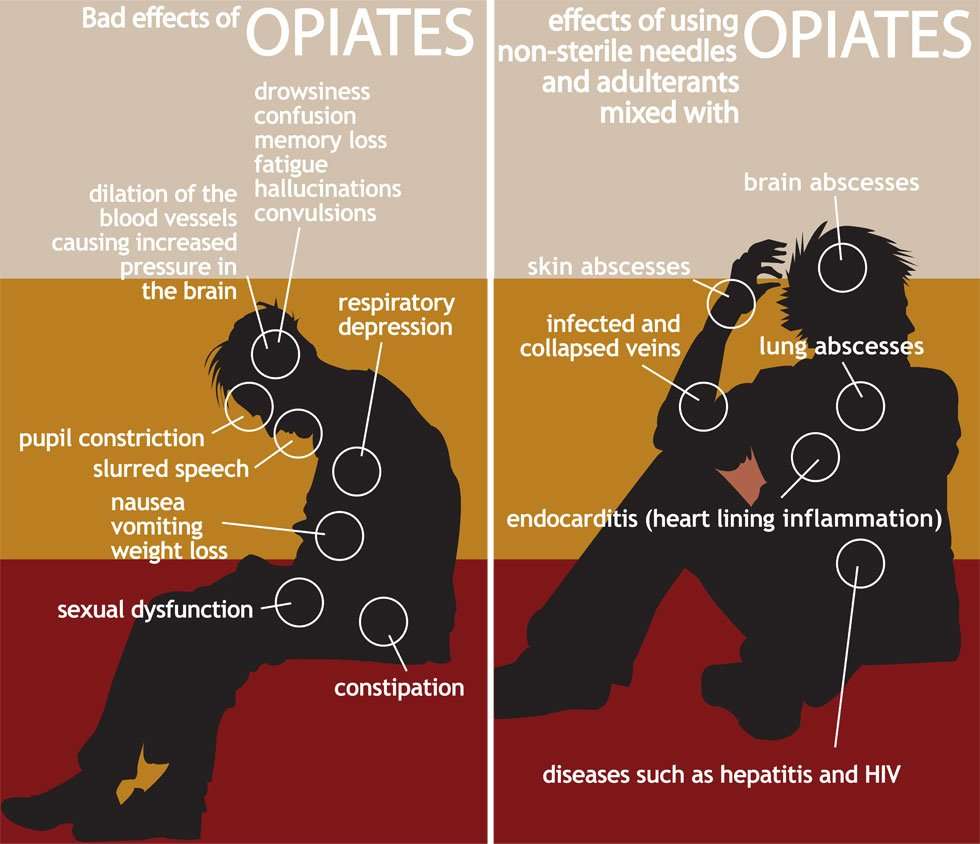 Health Effects of Opiate Addiction
