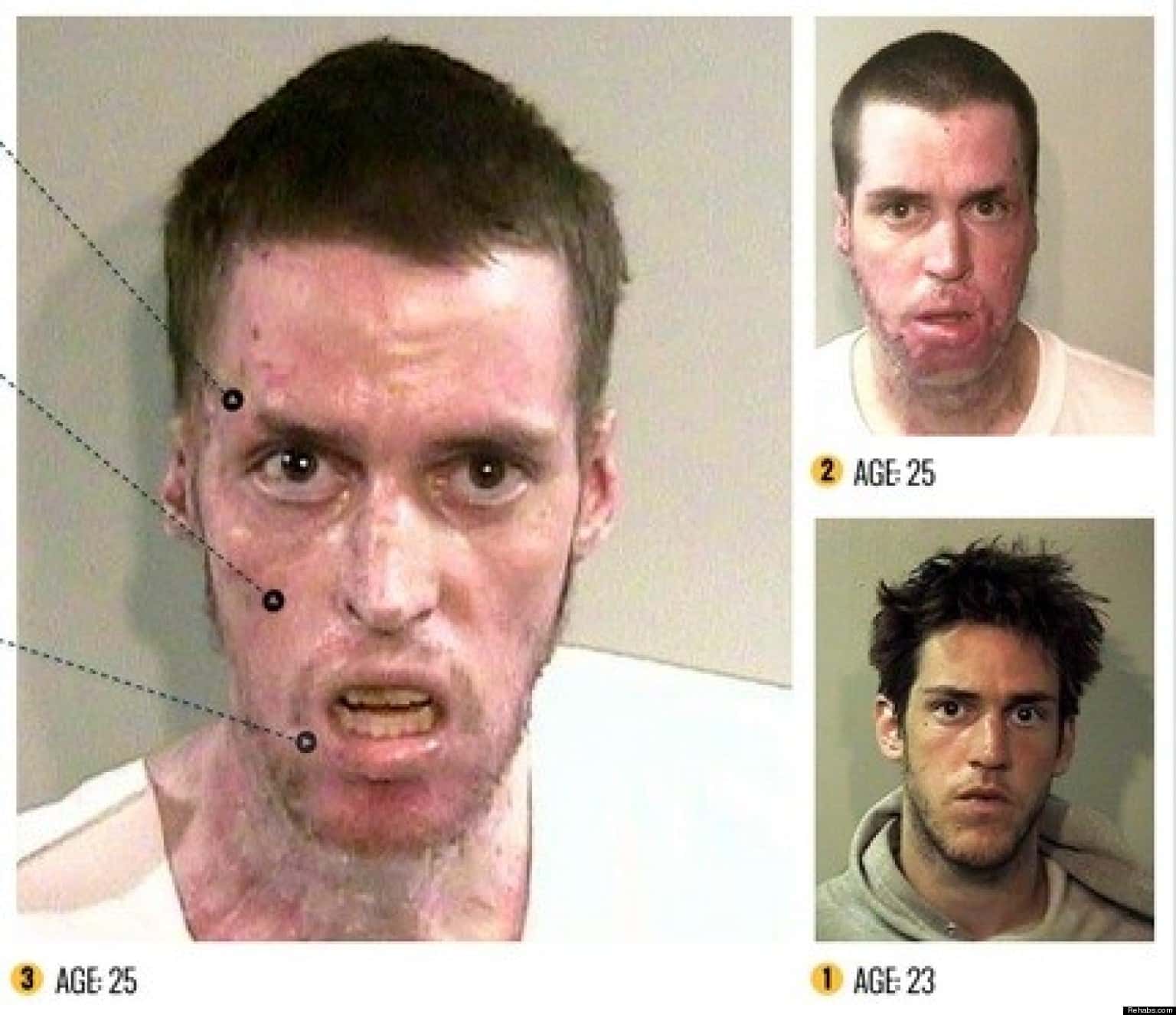 Horrors Of Methamphetamines By Rehabs.com Shows Faces Ravaged By ...