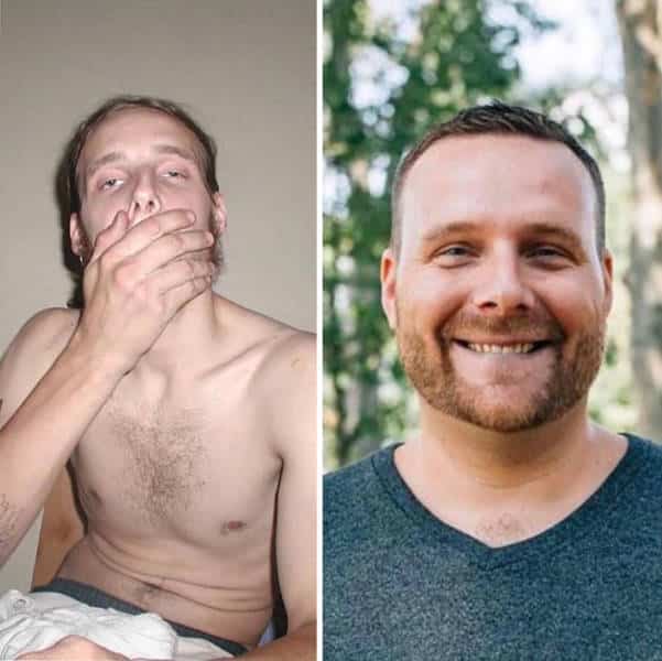 How Drug Addiction Looks Before And After (40 pics)
