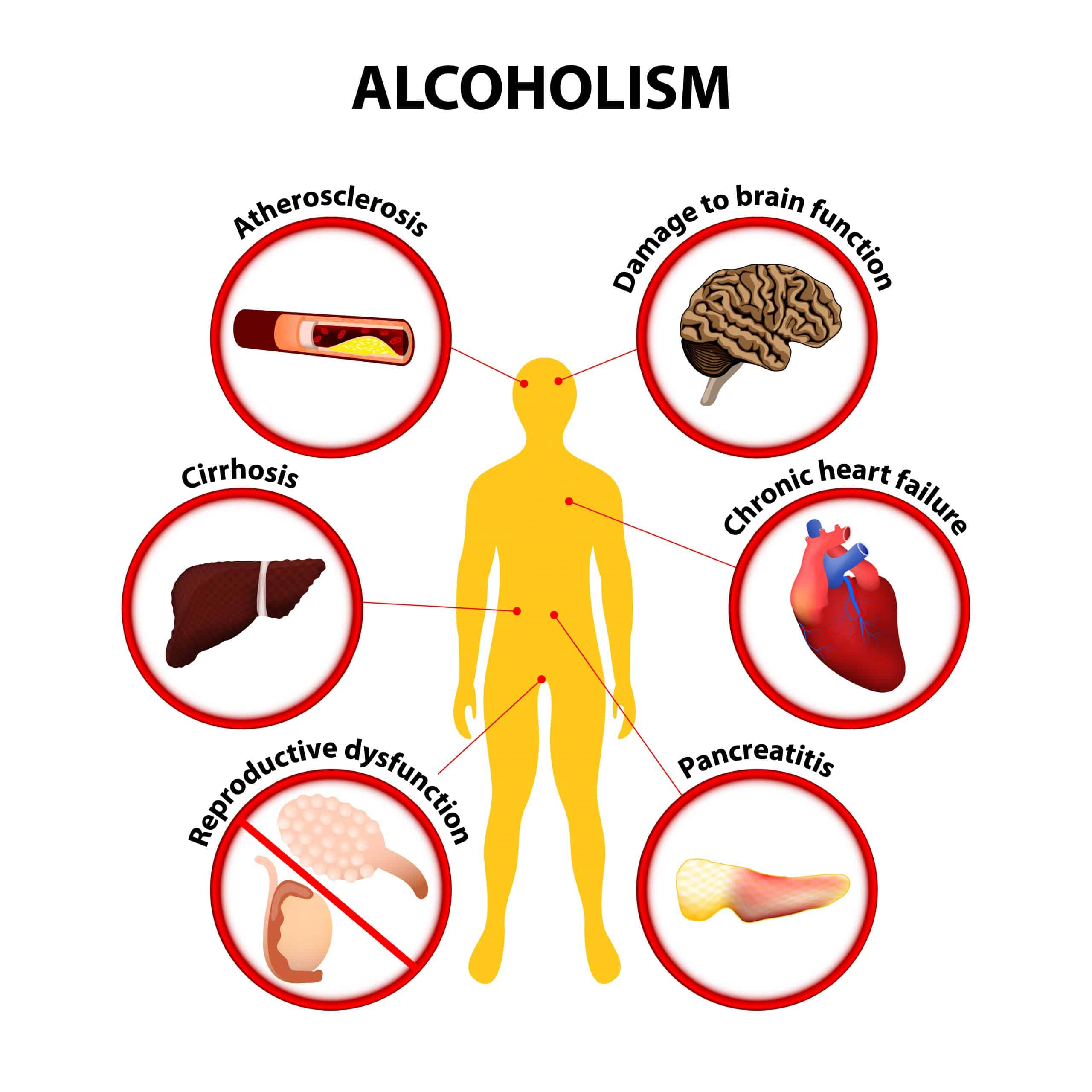 The Truth about What Alcohol Does to Your Body