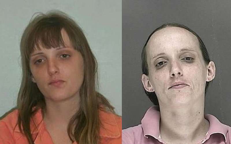 These Before And After Pictures Of Meth Users Will Shake ...